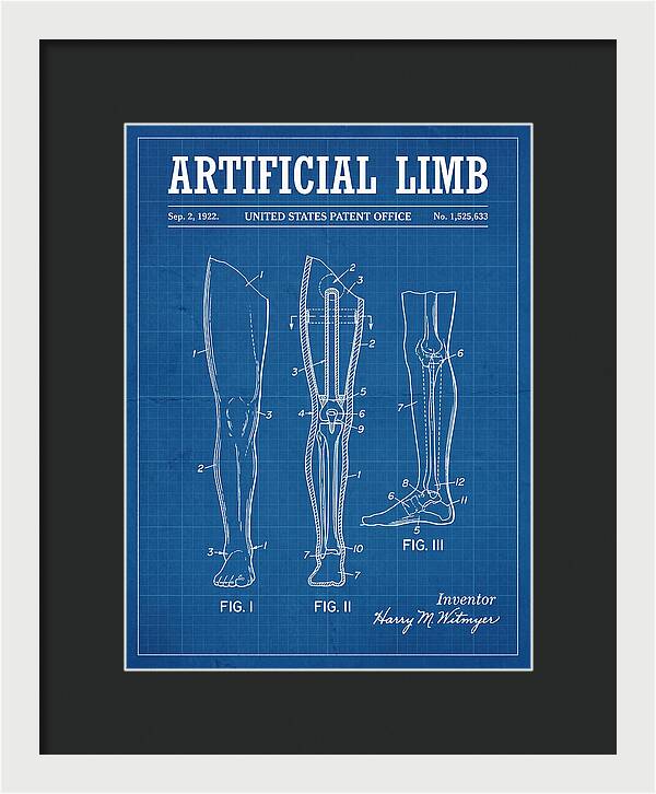 Artificial Limb Blueprint Patent Us1525633a