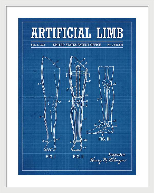Artificial Limb Blueprint Patent Us1525633a